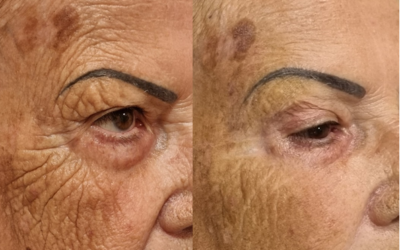 Curso Ultrassom Micro e Macrofocado | R$ 1399,90 (12x de R$ 116,66)