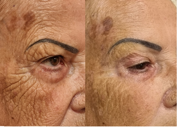 Curso Ultrassom Micro e Macrofocado | R$ 1399,90 (12x de R$ 116,66)